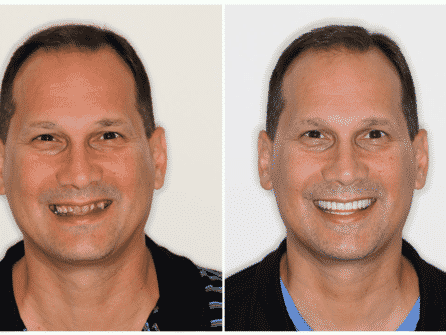 patient before and after