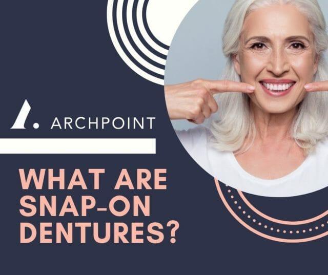 what are snap on dentures