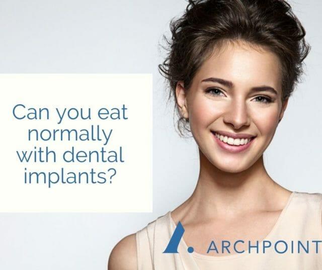 what can I eat with dental implants
