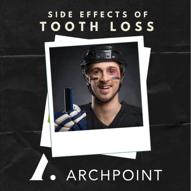 tooth loss and replacement options