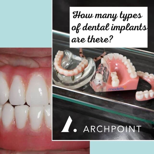types of dental implant designs