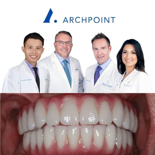 All-on-4 dental implants Fort Worth