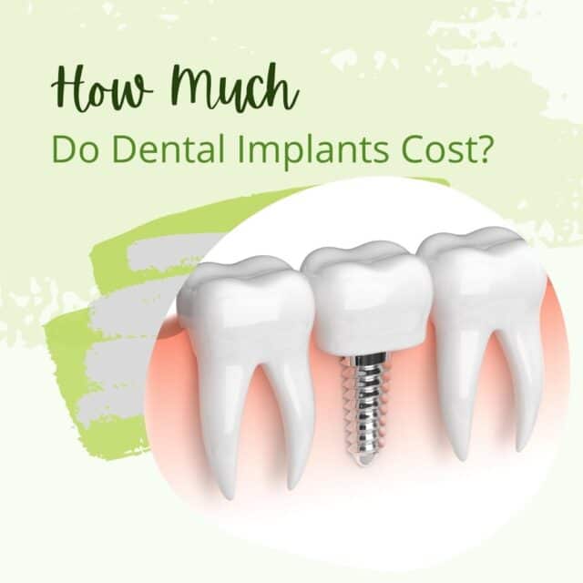 price of dental implants