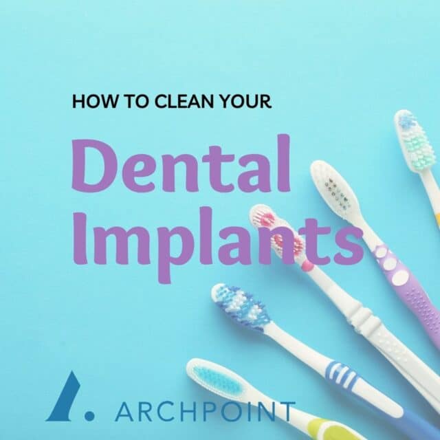 how to clean dental implants