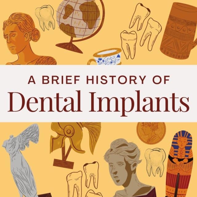 the history of dental implants
