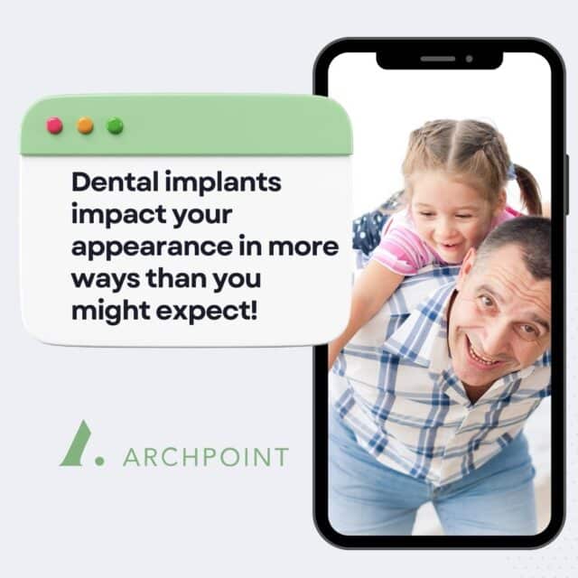 cosmetic dental implants DFW