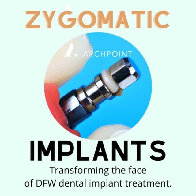 DFW zygomatic dental implants
