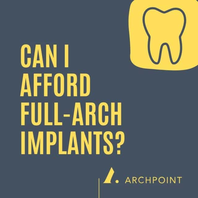 cost of full arch implants