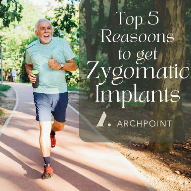 zygomatic implants