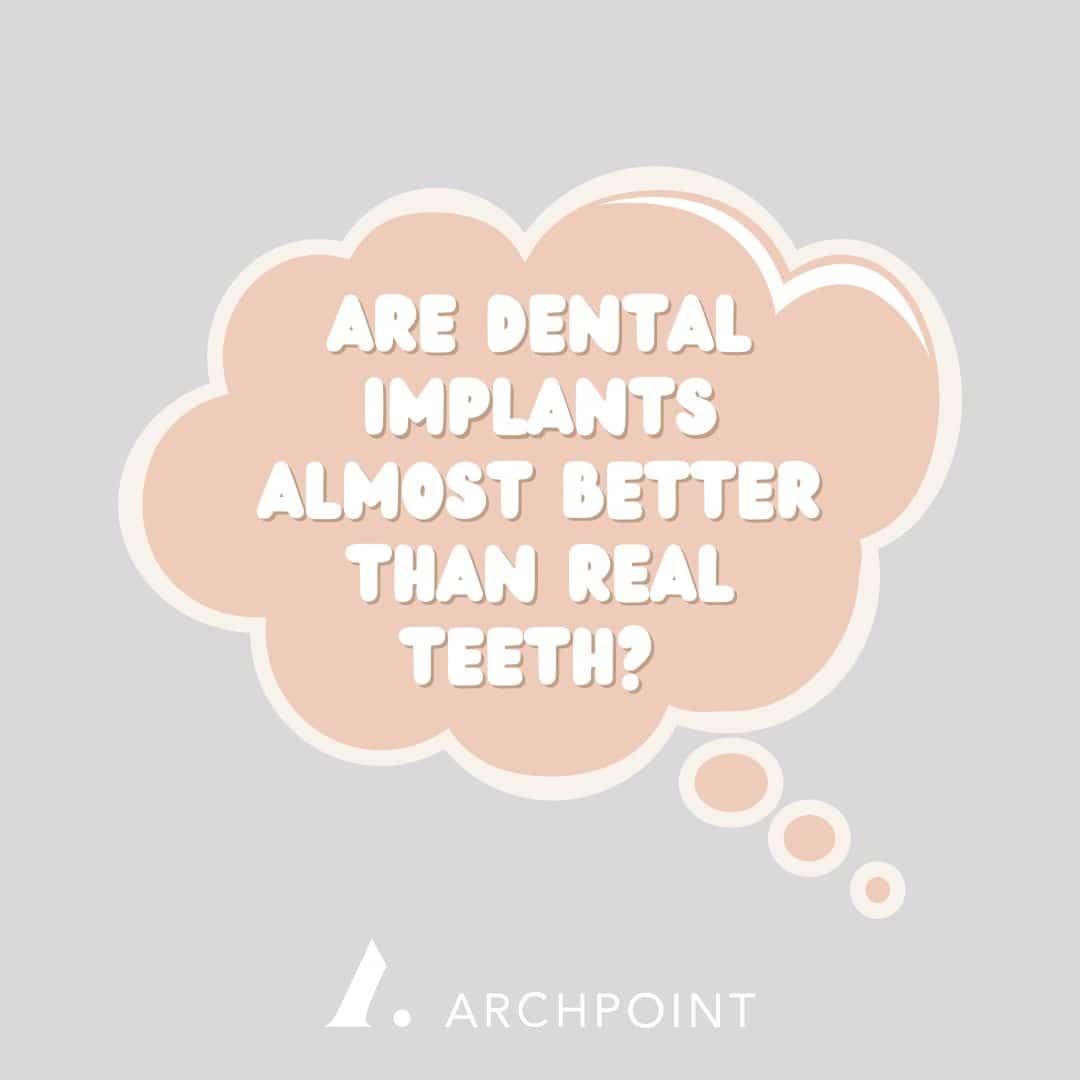 are dental implants better than real teeth