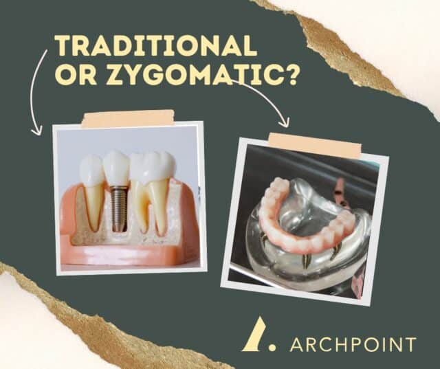 traditional vs zygomatic implants