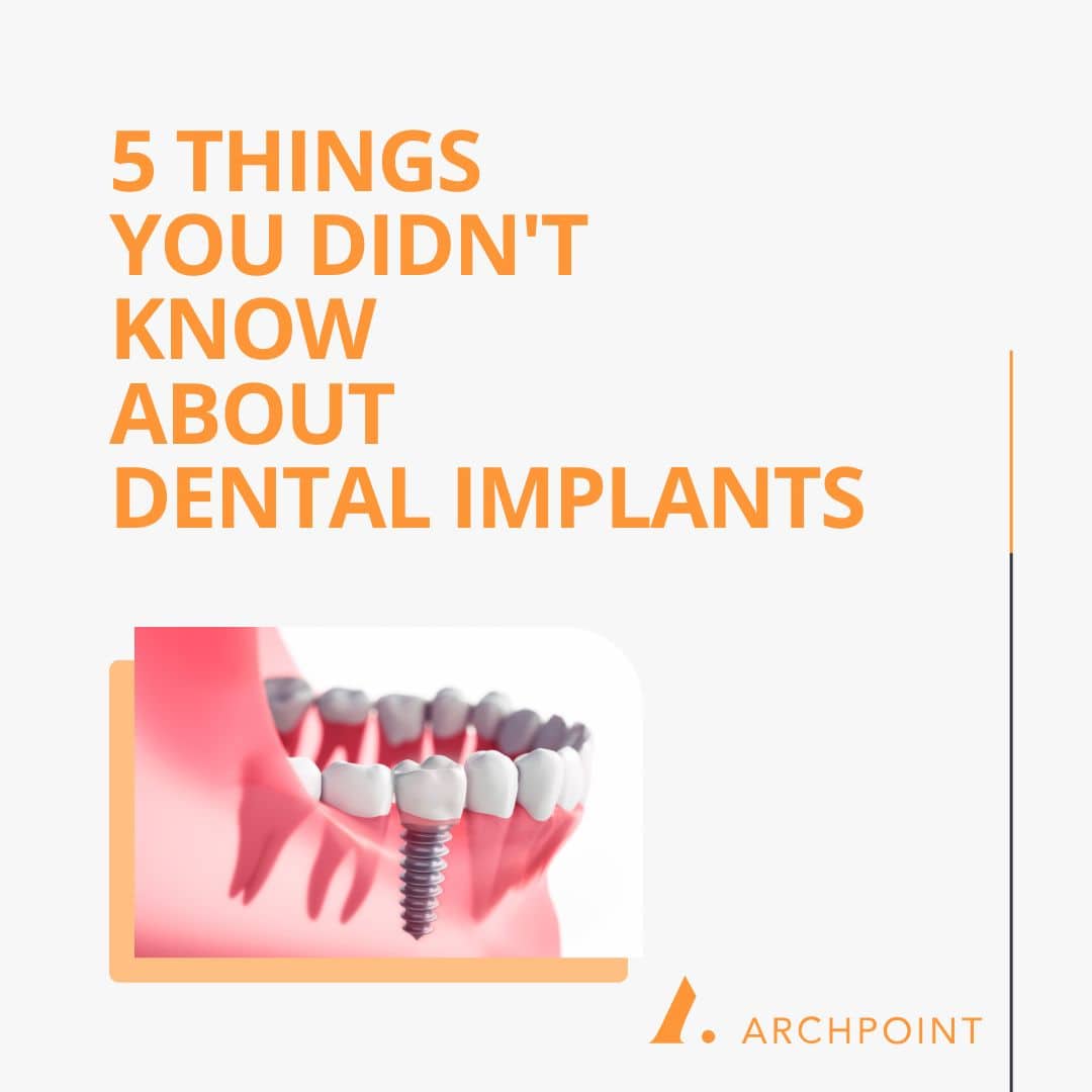 what to know about dental implants