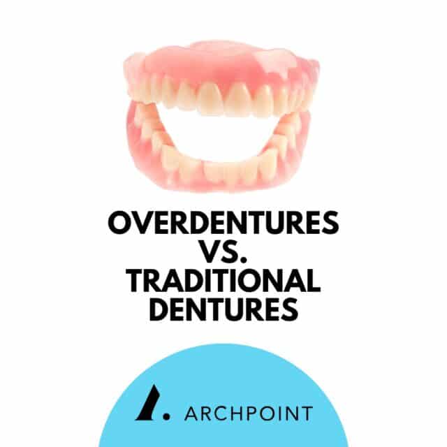 types of dentures: overdentures vs. traditional