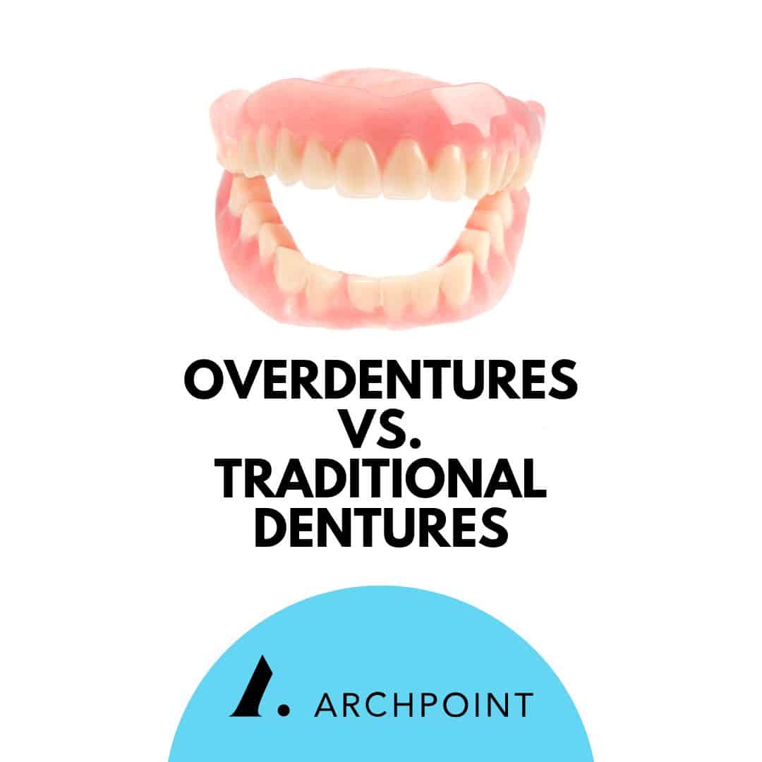 types of dentures: overdentures vs. traditional