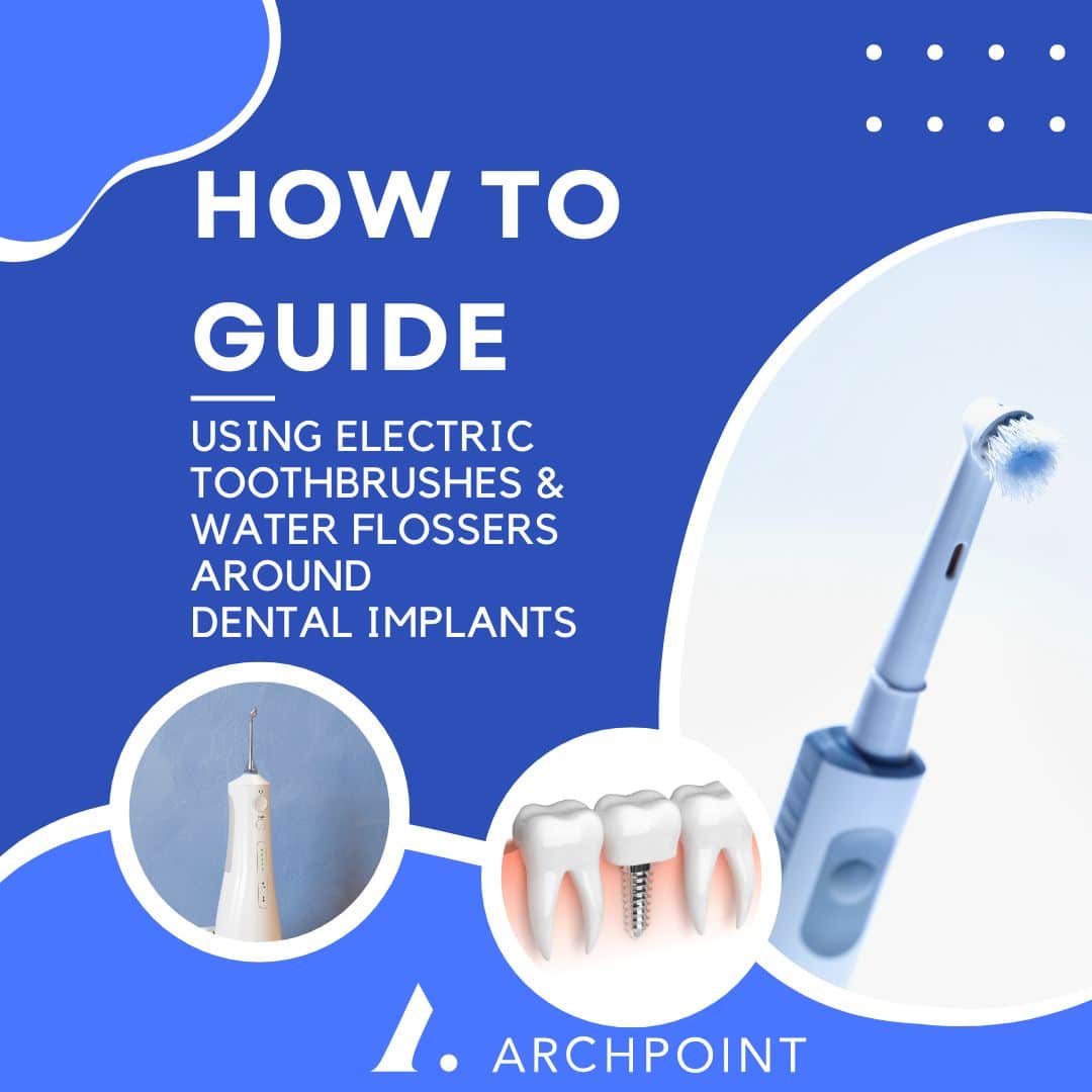 How To Guide: Electric Toothbrush and Water Flosser (with Implants)