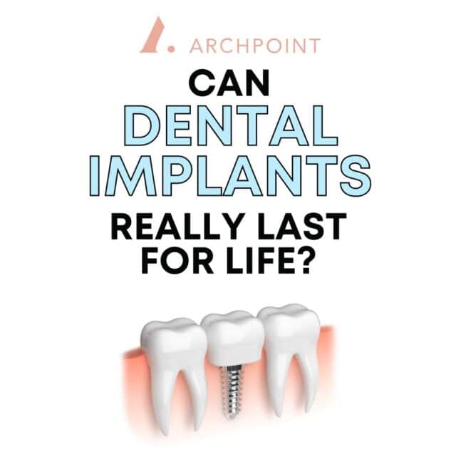 how long do dental implants last?