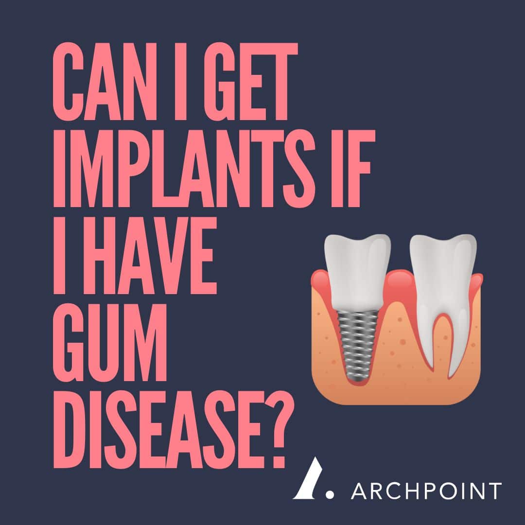 can i get dental implants if i have periodontitis?