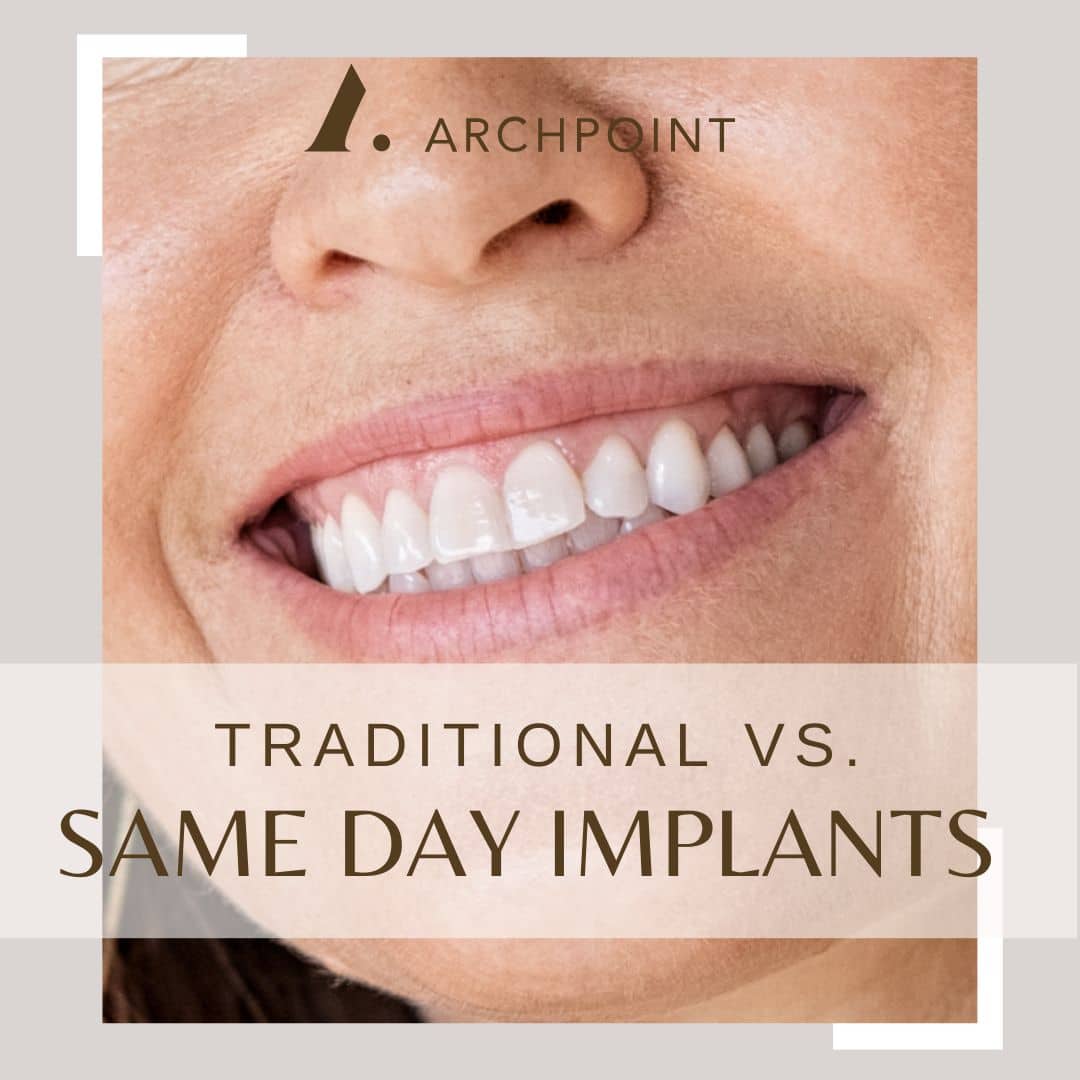 regular vs. same-day dental implants