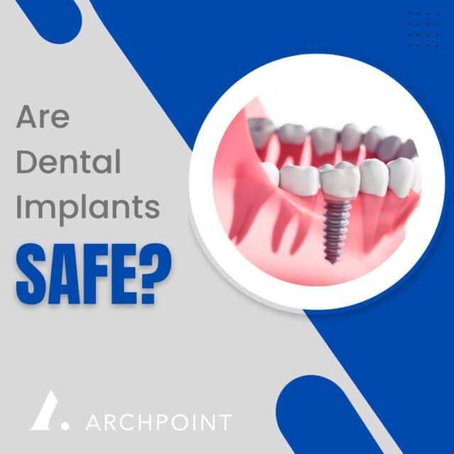 how safe are dental implants
