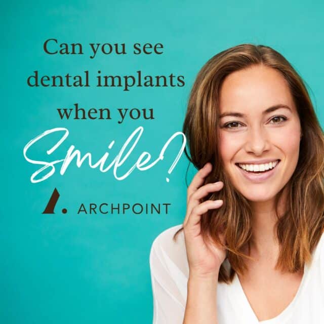 Are dental implants visible when you smile