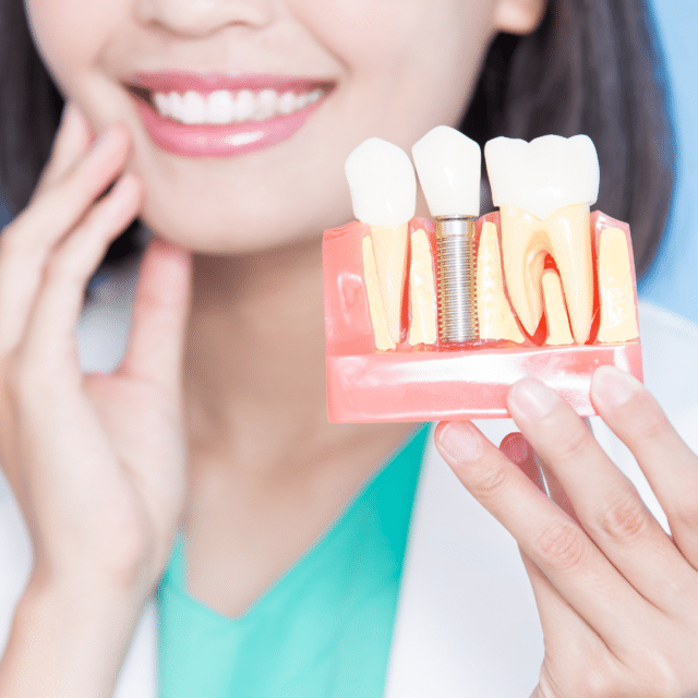 Dental Implants