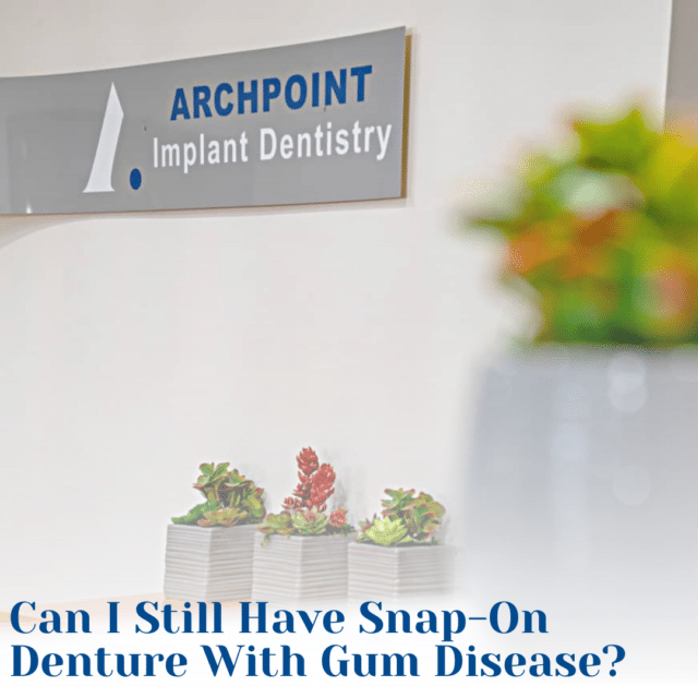 Gum Disease Snap-On Dentures
