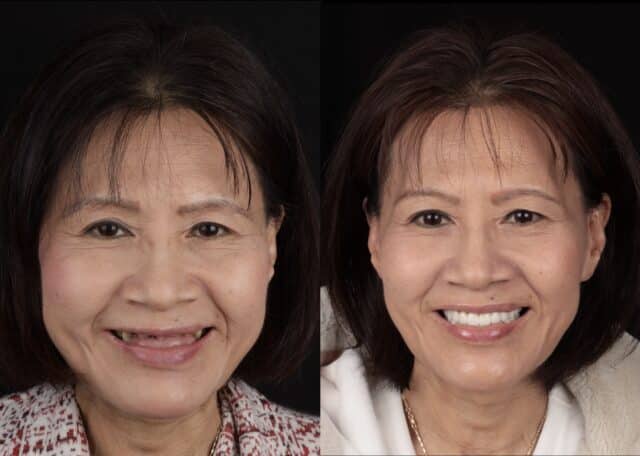 before-after