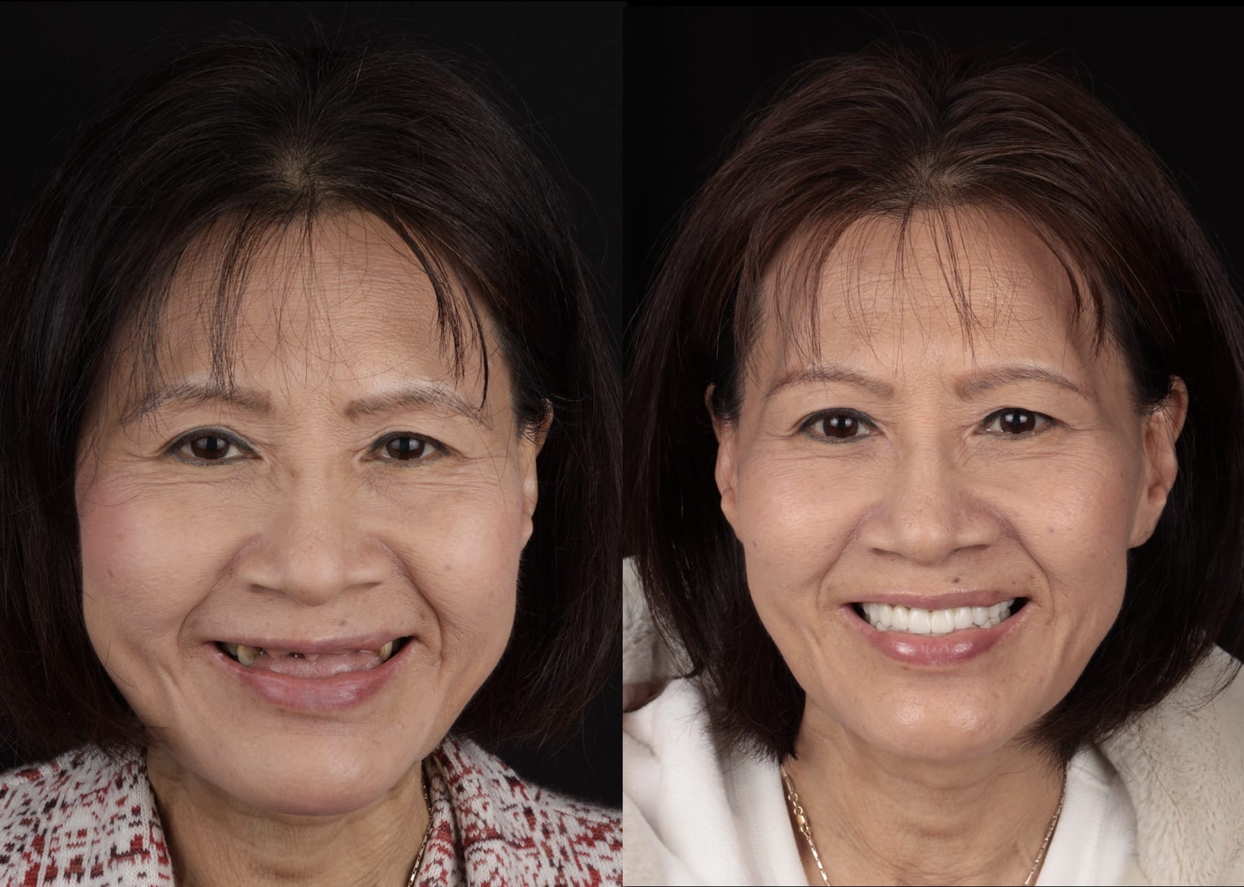 before-after