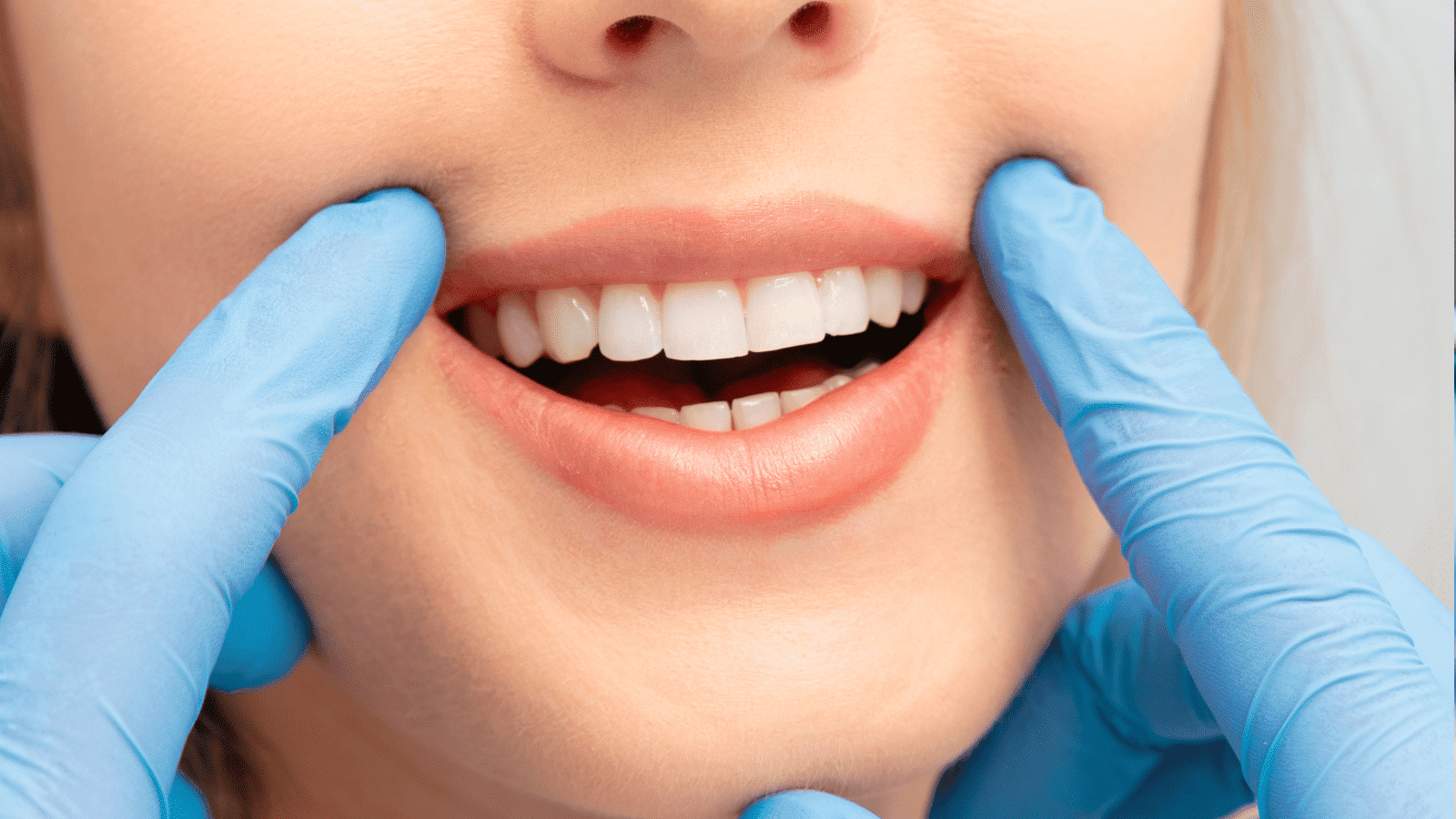 Dental Implant